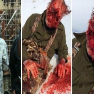 GRAPHIC: Man Loses Face in Alaskan Grizzly Bear Attack But Considers