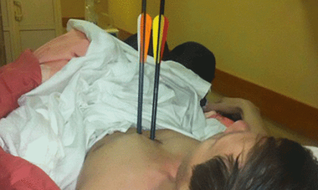 True Story: A Russian Guy Shot Himself TWICE with a Crossbow and Survived