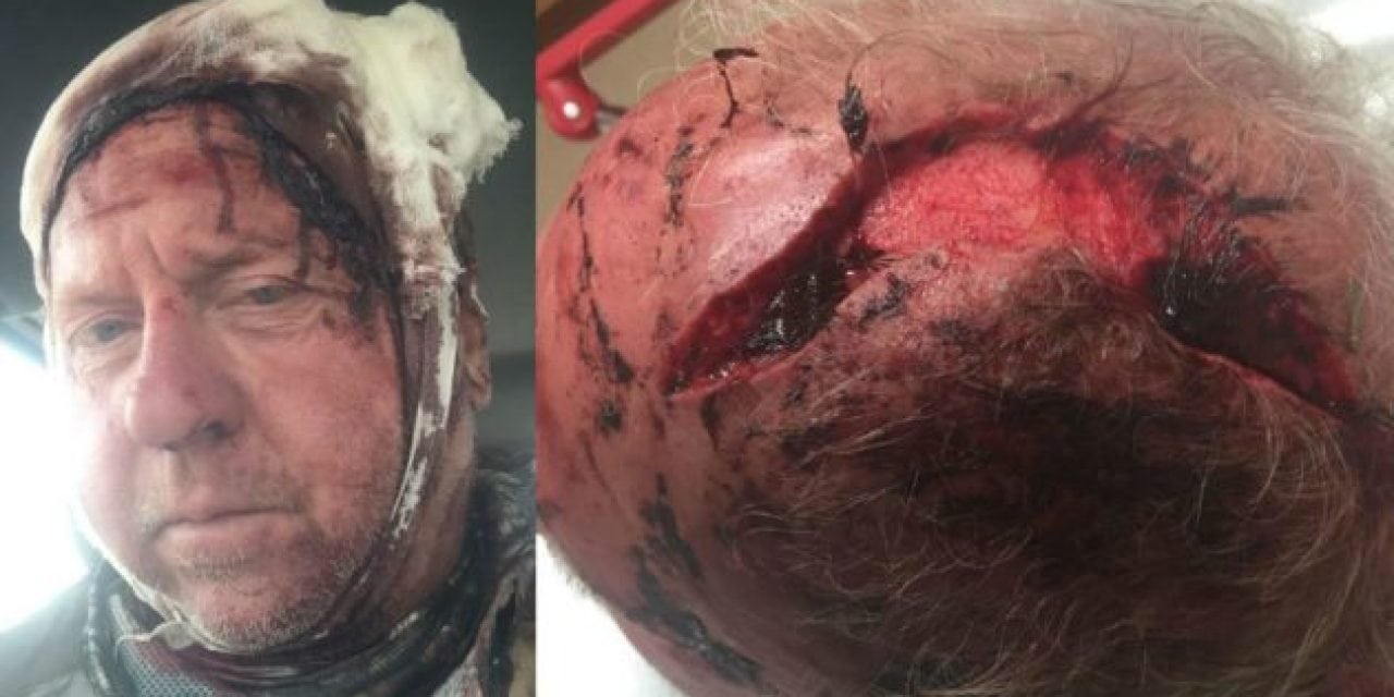 Graphic: Montana Grizzly Bear Attack Results in 90 Stitches to the Head for Elk Hunter
