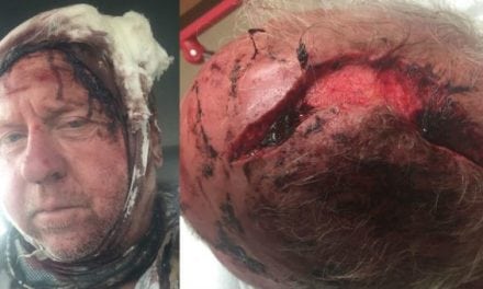 Graphic: Montana Grizzly Bear Attack Results in 90 Stitches to the Head for Elk Hunter