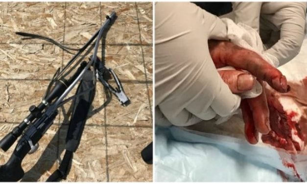 Gun Blows Up On Man and Yet Another Terrible and Gruesome Muzzleloader Explosion