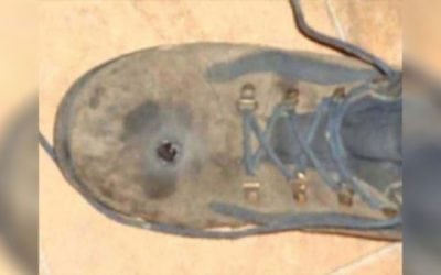 GRAPHIC: Man Thought His Steel-Toed Boots Would Stop a .45-Caliber Bullet