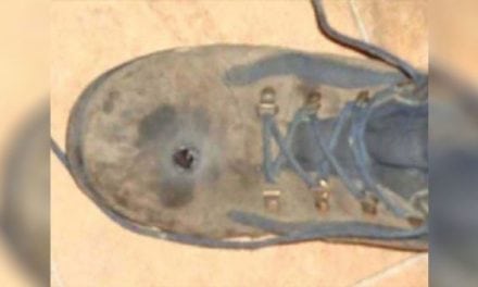 GRAPHIC: Man Thought His Steel-Toed Boots Would Stop a .45-Caliber Bullet