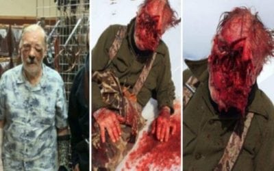 GRAPHIC: Man Loses Face in Alaskan Grizzly Bear Attack But Considers Himself Lucky to Be Alive