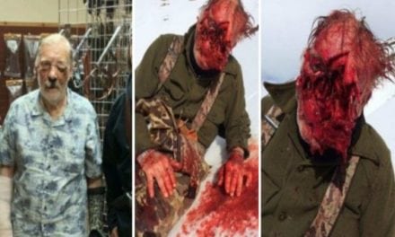 GRAPHIC: Man Loses Face in Alaskan Grizzly Bear Attack But Considers Himself Lucky to Be Alive