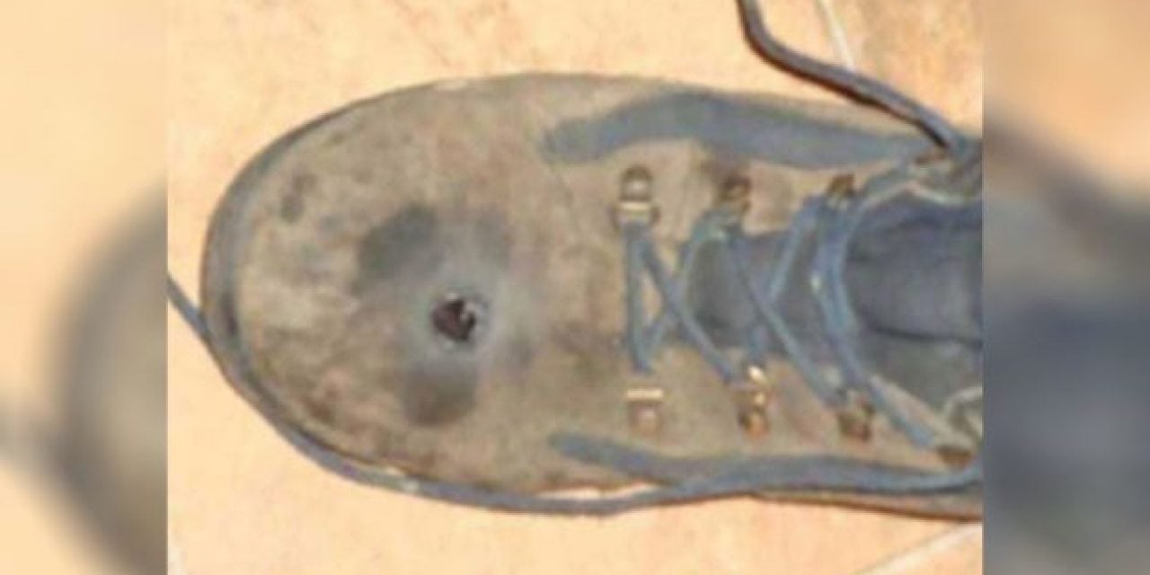 GRAPHIC: Man Thought Steel-Toed Boots Would Stop a .45-Caliber Bullet