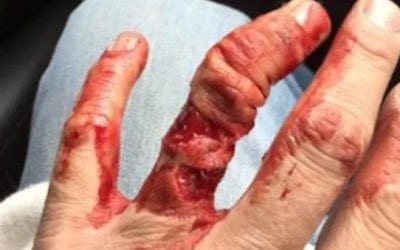 GRAPHIC: Why You Never Wear a Wedding Ring in a Deer Stand