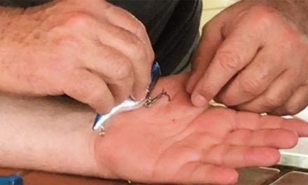 The Best Way to Remove a Fish Hook
