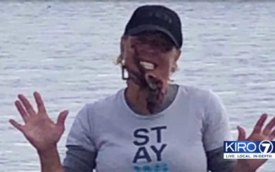 She Put an Octopus on Her Face for a Photo. It Bit Her and Sent Her to the Hospital