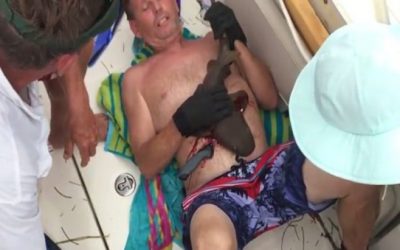 Can You Tell What Bit and Attached Itself to This Man’s Belly?