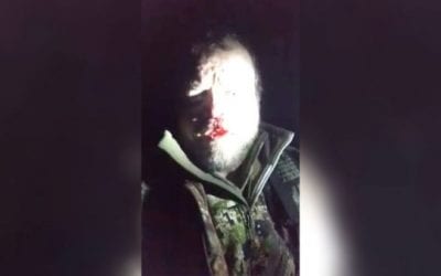 Hunter Shares Message of Safety Immediately After Treestand Gives Way