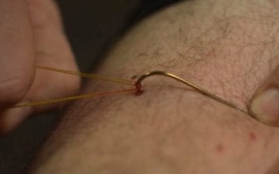 One of the Easy Ways to Remove a Fish Hook