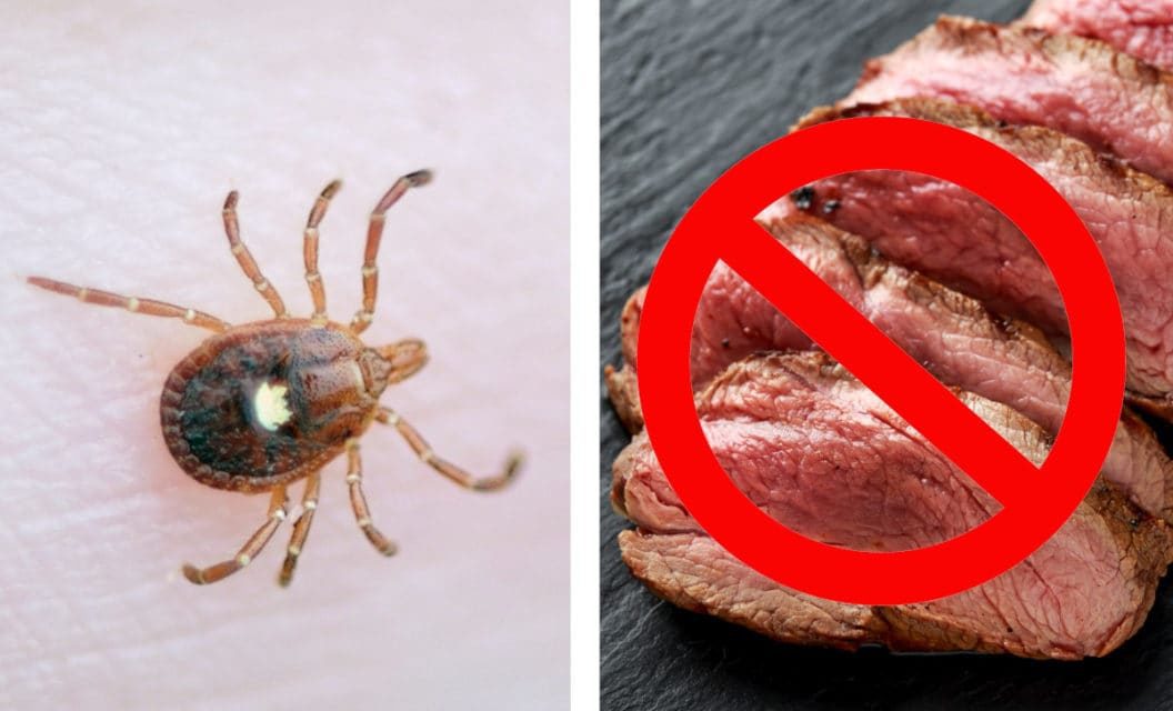 Alpha-Gal Syndrome: How Ticks Can Make You Allergic to Red Meat
