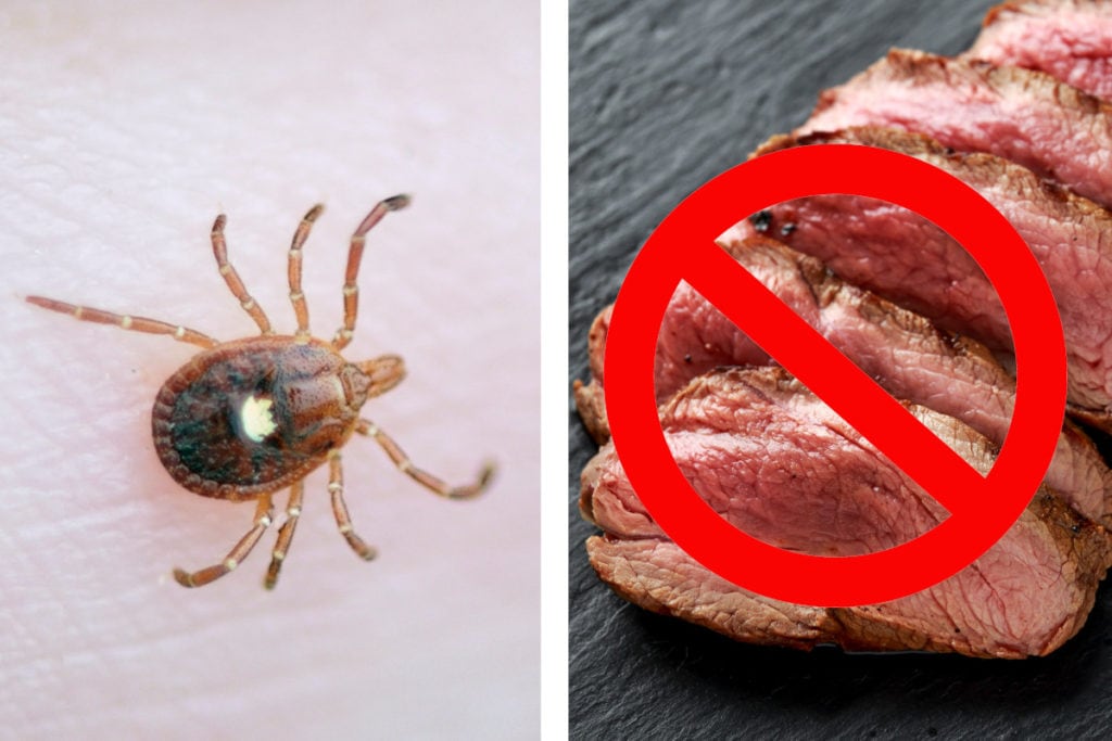 AlphaGal Syndrome How Ticks Can Make You Allergic to Red Meat