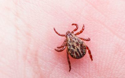 How To Safely Remove Ticks from Humans and Pets, According to Experts