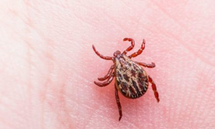 How To Safely Remove Ticks from Humans and Pets, According to Experts